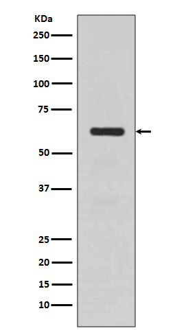 Western blot analysis of TGFBI expression in human fetal kidney lysate