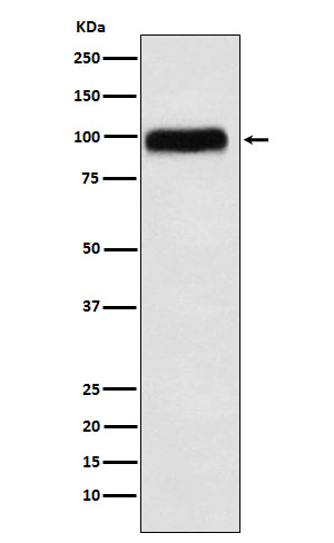 Western blot analysis of SERPING1 expression in Human plasma lysate