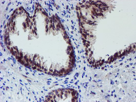 Immunohistochemical staining of paraffin-embedded Human prostate tissue within the normal limits using anti-ALOX15 mouse monoclonal antibody