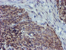 m01222 anti alox15 mouse monoclonal antibody clone id oti2g3 ihc testing 4