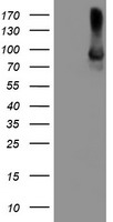 HEK293T cells were transfected with the pCMV6-ENTRY control (Left lane) or pCMV6-ENTRY ALOX15 (Right lane) cDNA for 48 hrs and lysed