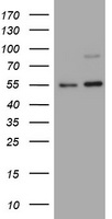 HEK293T cells were transfected with the pCMV6-ENTRY control (Left lane) or pCMV6-ENTRY TNFRSF8 (Right lane) cDNA for 48 hrs and lysed