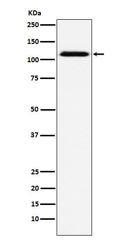 Western blot analysis of CD30 expression in A431 cell lysate