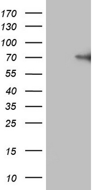 HEK293T cells were transfected with the pCMV6-ENTRY control (Left lane) or pCMV6-ENTRY F12 (Right lane) cDNA for 48 hrs and lysed