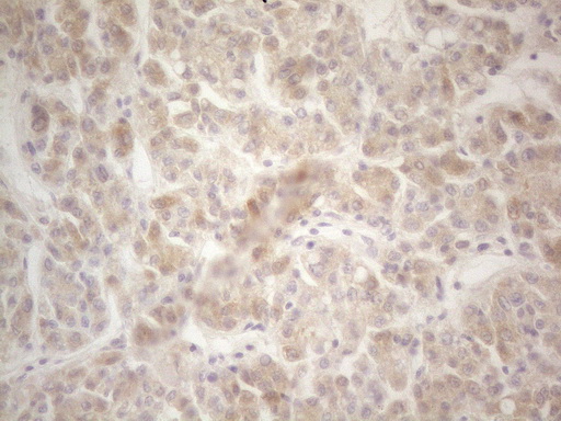Immunohistochemical staining of paraffin-embedded Human liver tissue using anti-F12 mouse monoclonal antibody