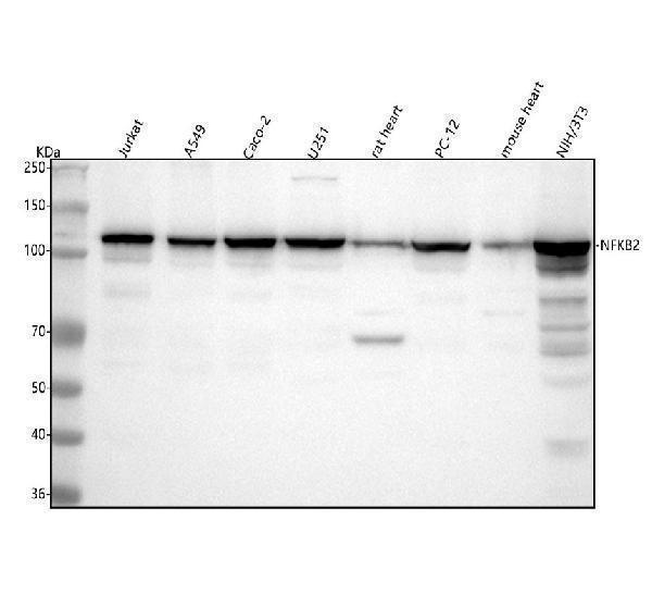  Western blot analysis of NF-κB p100/p52 using anti-NF-κB p100/p52 antibody (M01228-1)