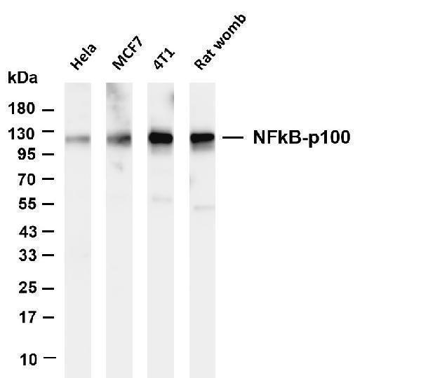 Various whole cell lysates were separated by 4-20% SDS-PAGE, and the membrane was blotted with anti-NFkB p100 antibody