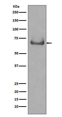 Western blot analysis of Lamin B Receptor expression in Jurkat cell lysate