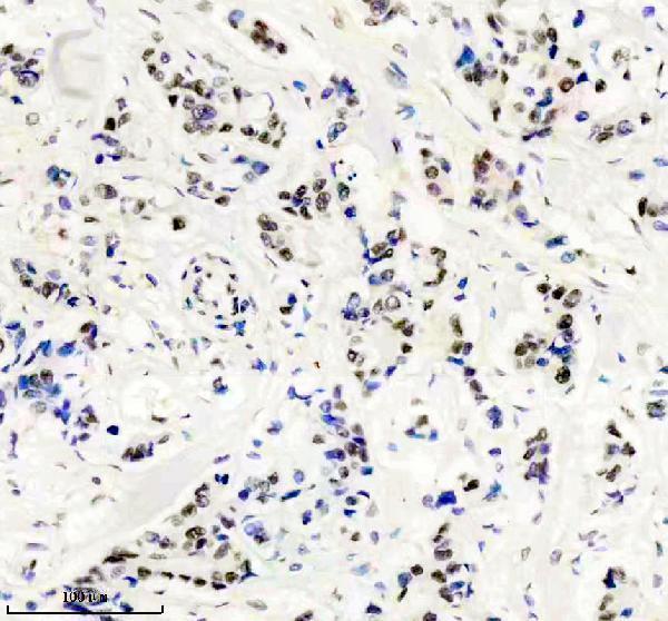 m01239 uspt primary antibodies ihc testing 1