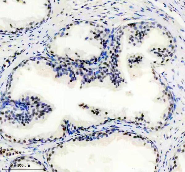 m01239 uspt primary antibodies ihc testing 2