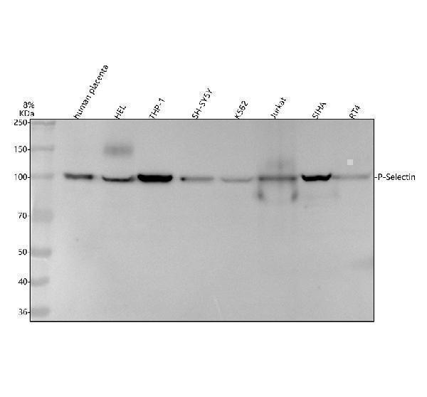 Western blot analysis of P-Selectin/SELP using anti-P-Selectin/SELP antibody (M01241)