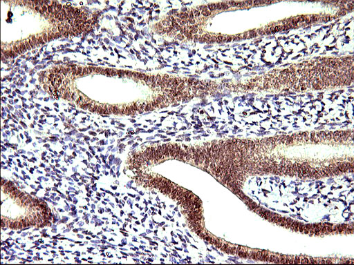 Immunohistochemical staining of paraffin-embedded Human endometrium tissue within the normal limits using anti-APOA5 mouse monoclonal antibody