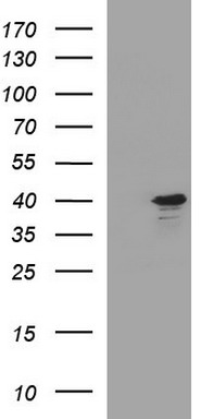 HEK293T cells were transfected with the pCMV6-ENTRY control (Left lane) or pCMV6-ENTRY APOA5 (Right lane) cDNA for 48 hrs and lysed