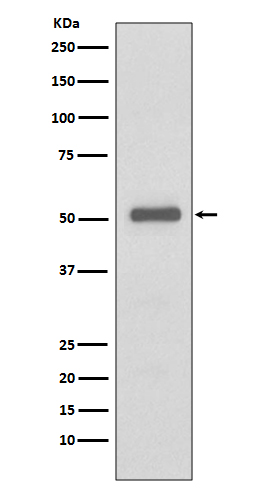Western blot analysis on HeLa cell using p57 Kip2 Antibody