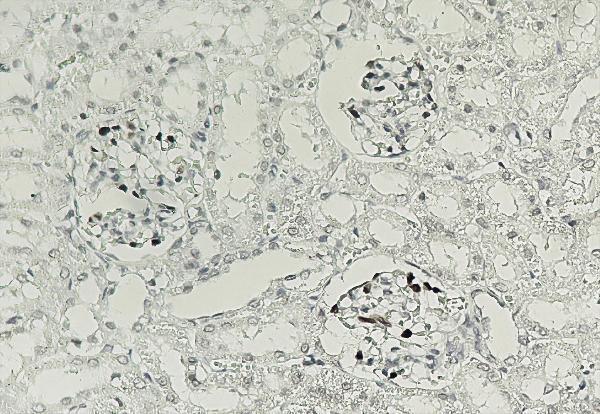 Human kidney tissue was stained with anti-p57kip2 rabbit Antibody
