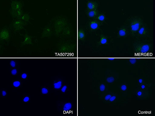 m01245 1 anti albumin alb mouse monoclonal antibody clone id oti5h2 if testing 4