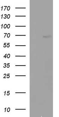 HEK293T cells were transfected with the pCMV6-ENTRY control (Left lane) or pCMV6-ENTRY ALB (Right lane) cDNA for 48 hrs and lysed