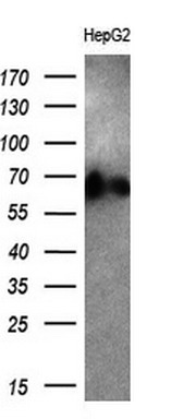 Western blot analysis of extracts (10ug) from 1 cell line by using anti-ALB monoclonal antibody (1:200)