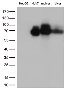 Western blot analysis of extracts (35ug) from 2 cell lines and 2 tissues lysates by using anti-ALB monoclonal antibody (1:1000)