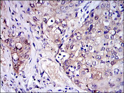 m01247 1 irak4 primary antibodyes ihc testing 2