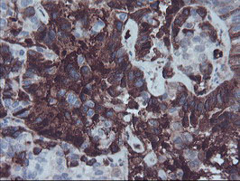 m01251 anti fetuin a ahsg mouse monoclonal antibody clone id oti2h2 ihc testing 3