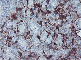 m01251 anti fetuin a ahsg mouse monoclonal antibody clone id oti2h2 ihc testing 4
