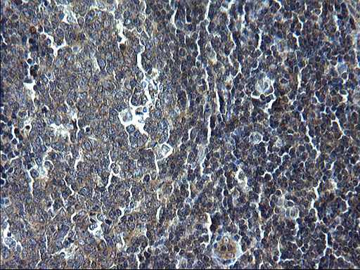 Immunohistochemical staining of paraffin-embedded Human lymph node tissue within the normal limits using anti-KITLG mouse monoclonal antibody