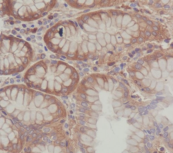 Immunohistochemical analysis of paraffin-embedded human stomach, using SCF Antibody