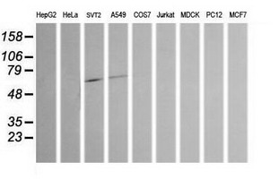 m01256 2 anti chromogranin a chga mouse monoclonal antibody clone id oti2e12 wb testing 2