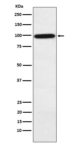 Western blot analysis of Complement factor B expression in Human plasma lysate