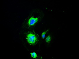 m01262 1 anti melanoma gp100 pmel mouse monoclonal antibody clone id oti10e5 if testing 19