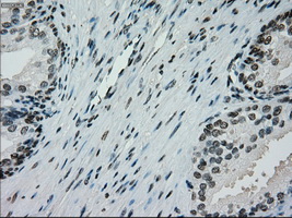 m01262 1 anti melanoma gp100 pmel mouse monoclonal antibody clone id oti10e5 ihc testing 10