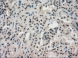 m01262 1 anti melanoma gp100 pmel mouse monoclonal antibody clone id oti10e5 ihc testing 12