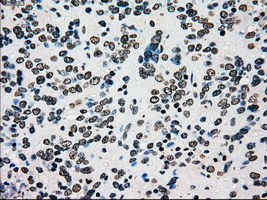m01262 1 anti melanoma gp100 pmel mouse monoclonal antibody clone id oti10e5 ihc testing 13
