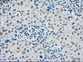 m01262 1 anti melanoma gp100 pmel mouse monoclonal antibody clone id oti10e5 ihc testing 14