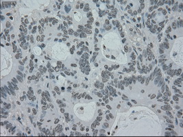 m01262 1 anti melanoma gp100 pmel mouse monoclonal antibody clone id oti10e5 ihc testing 15
