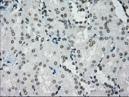 m01262 1 anti melanoma gp100 pmel mouse monoclonal antibody clone id oti10e5 ihc testing 16
