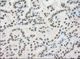 m01262 1 anti melanoma gp100 pmel mouse monoclonal antibody clone id oti10e5 ihc testing 17