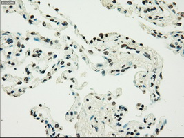 m01262 1 anti melanoma gp100 pmel mouse monoclonal antibody clone id oti10e5 ihc testing 18