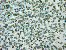 m01262 1 anti melanoma gp100 pmel mouse monoclonal antibody clone id oti10e5 ihc testing 4
