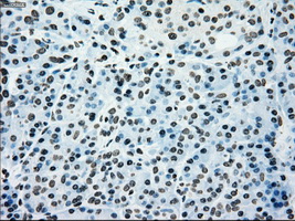 m01262 1 anti melanoma gp100 pmel mouse monoclonal antibody clone id oti10e5 ihc testing 5