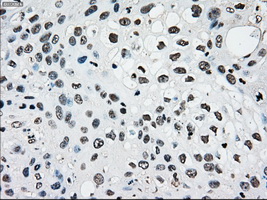 m01262 1 anti melanoma gp100 pmel mouse monoclonal antibody clone id oti10e5 ihc testing 6