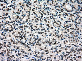 m01262 1 anti melanoma gp100 pmel mouse monoclonal antibody clone id oti10e5 ihc testing 7