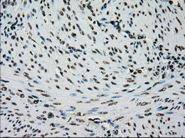 m01262 1 anti melanoma gp100 pmel mouse monoclonal antibody clone id oti10e5 ihc testing 8