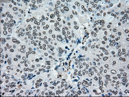 m01262 1 anti melanoma gp100 pmel mouse monoclonal antibody clone id oti10e5 ihc testing 9