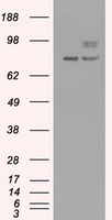 HEK293T cells were transfected with the pCMV6-ENTRY control (Left lane) or pCMV6-ENTRY SILV (Right lane) cDNA for 48 hrs and lysed