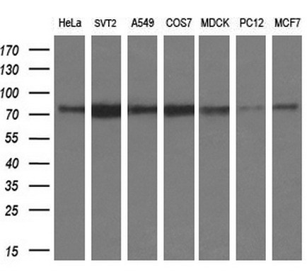 Western blot analysis of extracts (10ug) from 7 different cell lines by using anti-SILV monoclonal antibody at 1:200 dilution