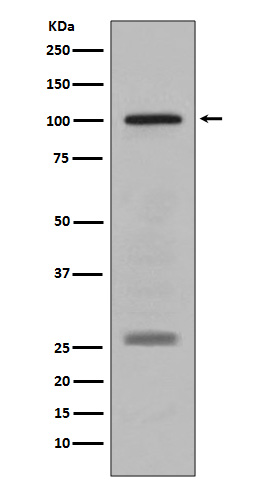 Western blot analysis of PMEL17 / GP100 expression in human melanoma lysate