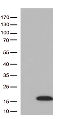 HEK293T cells were transfected with the pCMV6-ENTRY control (Left lane) or pCMV6-ENTRY DBI (Right lane) cDNA for 48 hrs and lysed