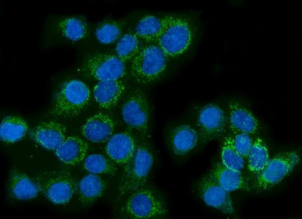 m01272 2 gls primary antibodies if testing 7